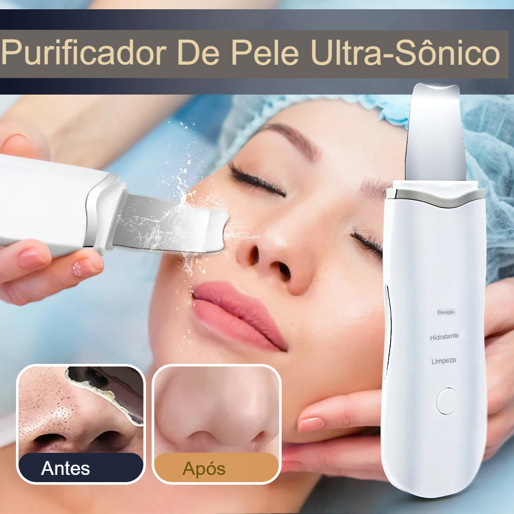 Esfoliante ultrassônico para pele
