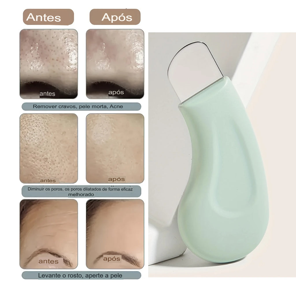 Ferramenta de remoção de cravo facial