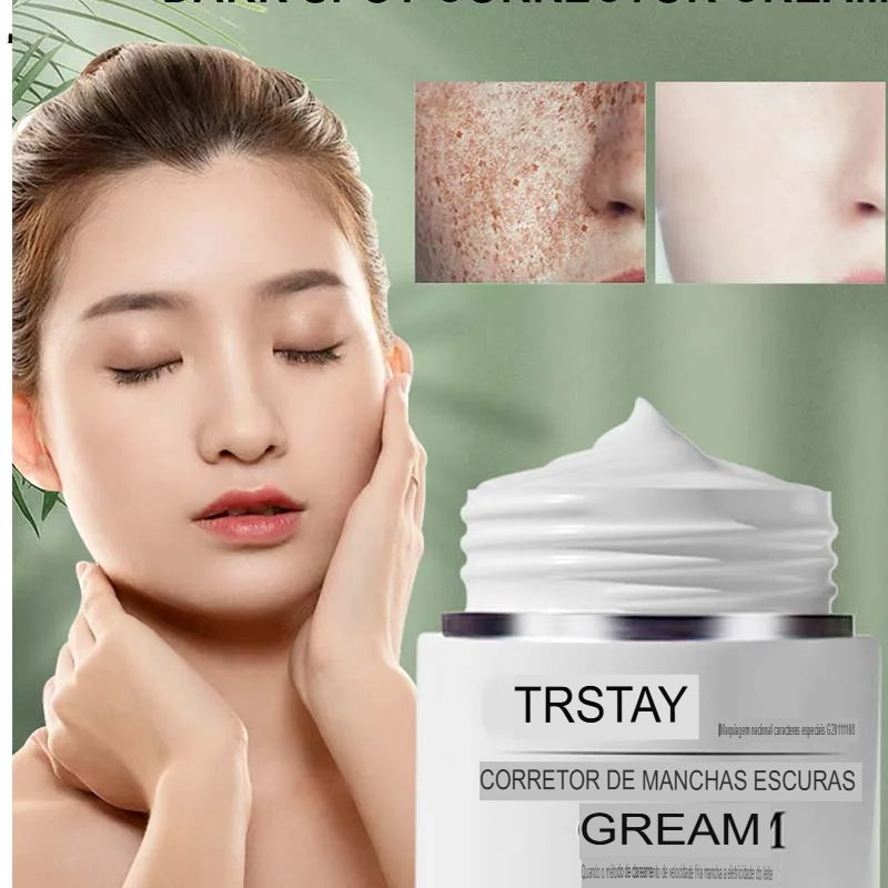 Creme contra Manchas solares cloasma arbutin anti-envelhecimento iluminando