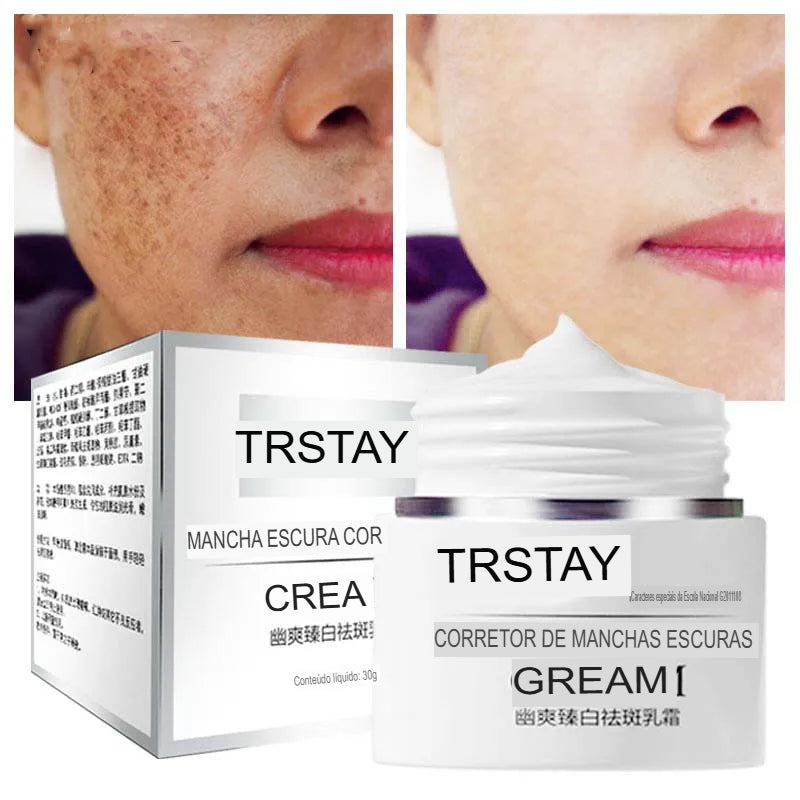 Creme contra Manchas solares cloasma arbutin anti-envelhecimento iluminando