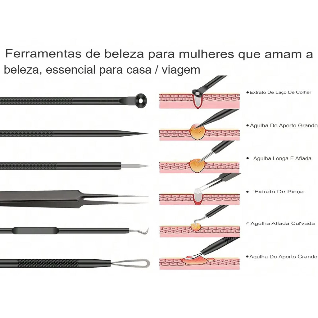 Kit de ferramentas para estourar espinhas com 6 peças