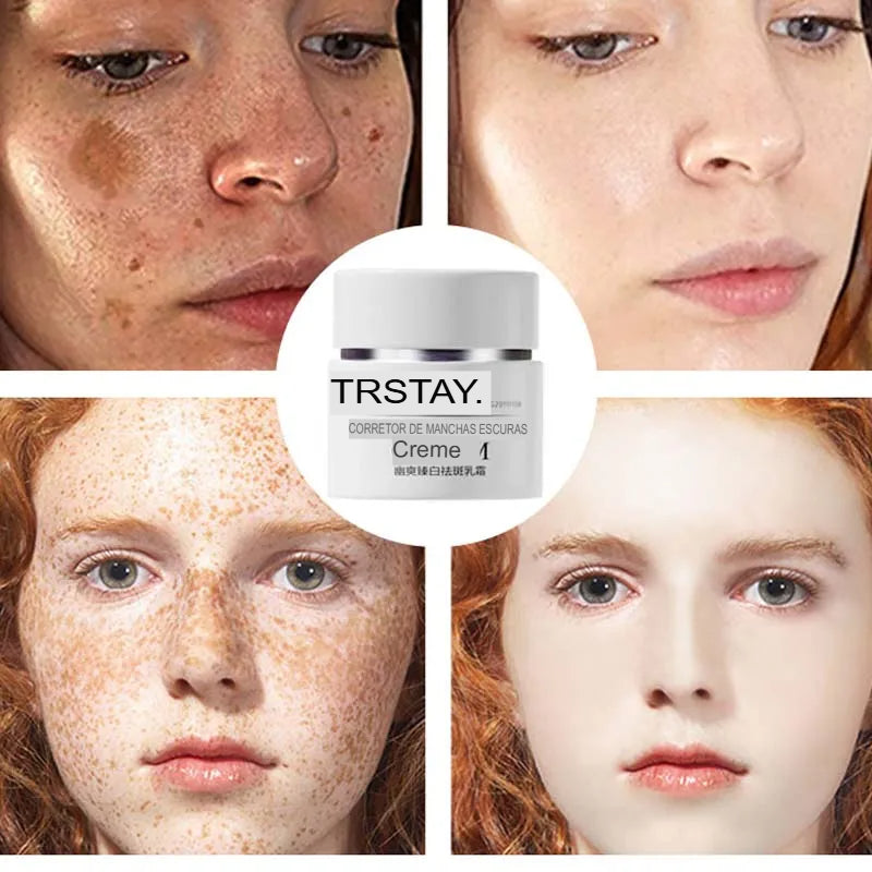 Creme contra Manchas solares cloasma arbutin anti-envelhecimento iluminando