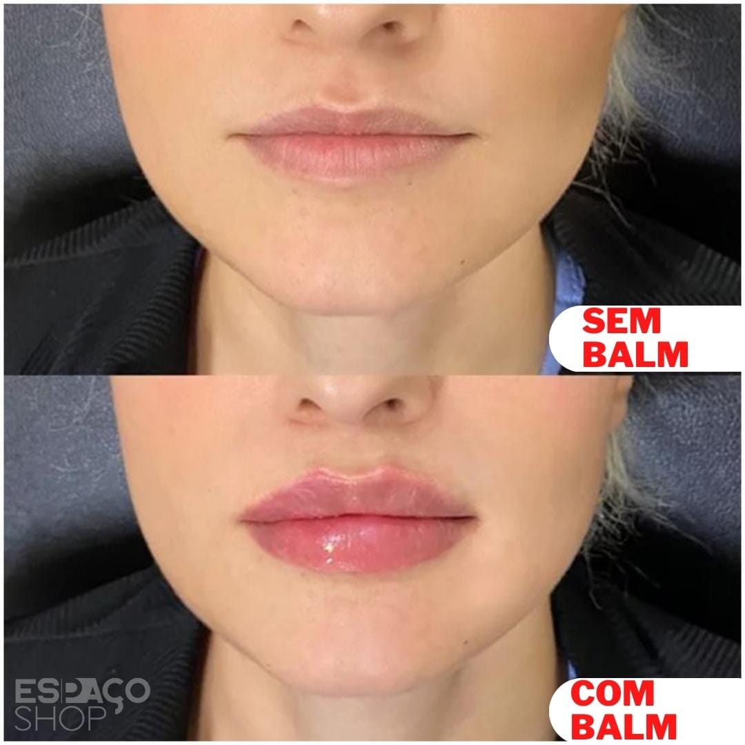 kit com 6 Lip Balm Therapy Natural