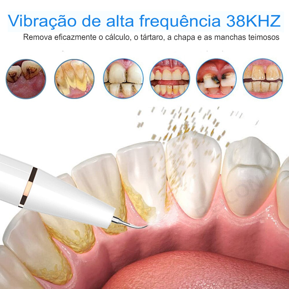 Ultrasonic Dental Scaler