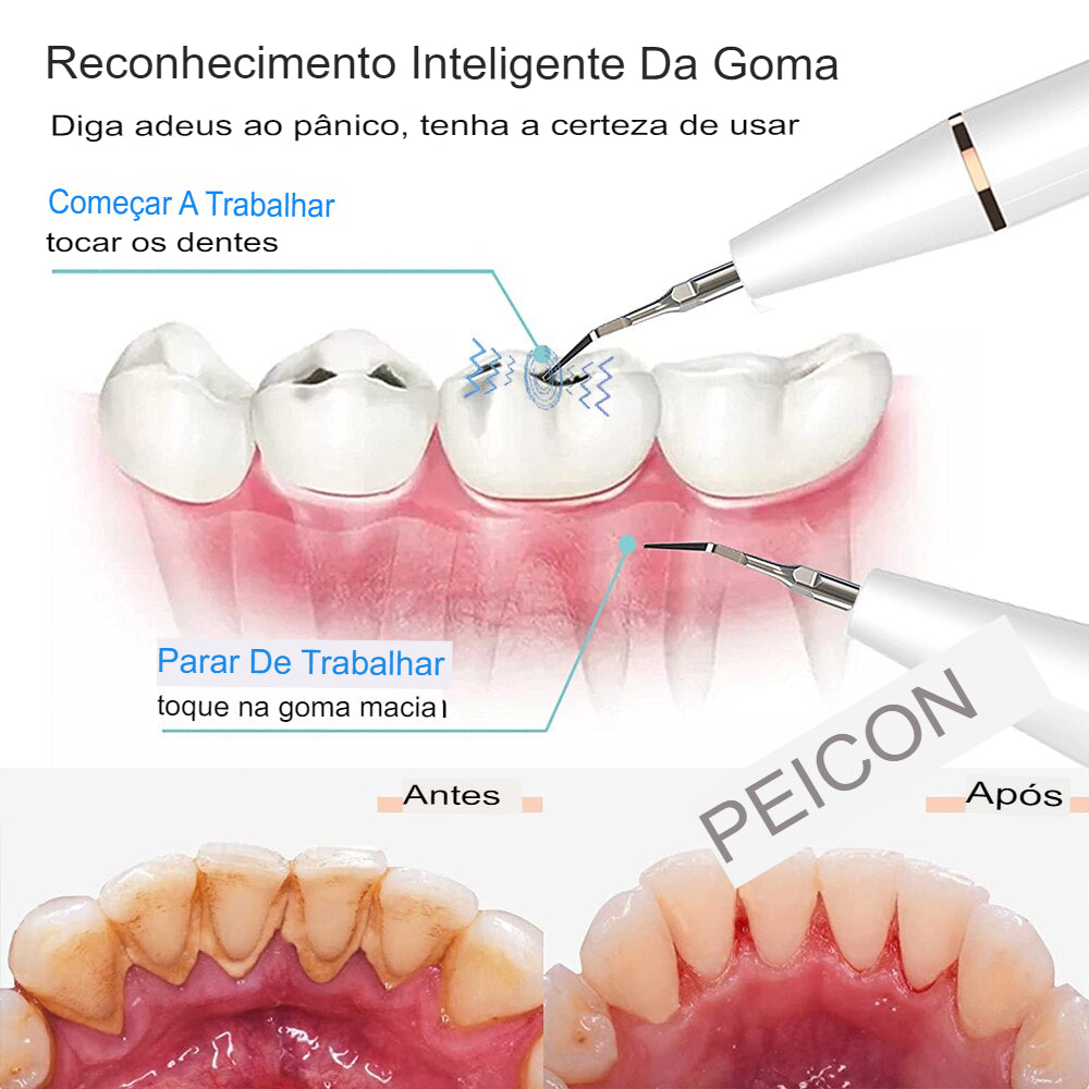 Ultrasonic Dental Scaler