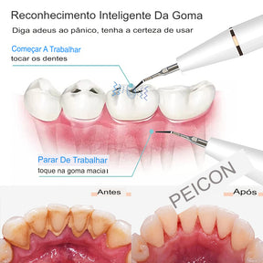 Ultrasonic Dental Scaler