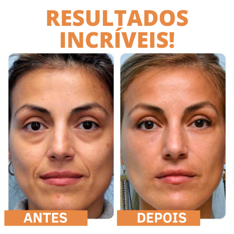 Kit Máscara GoldBotox + Spray VitaC GRÁTIS HOJE