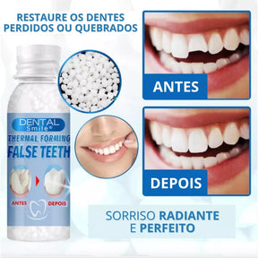 Restaurador Dental Smile®